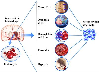 Mesenchymal Stem Cells Transplantation in Intracerebral Hemorrhage: Application and Challenges